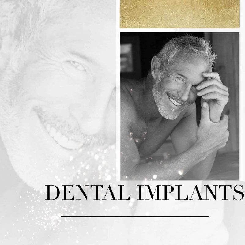 Dental Implants Homepage