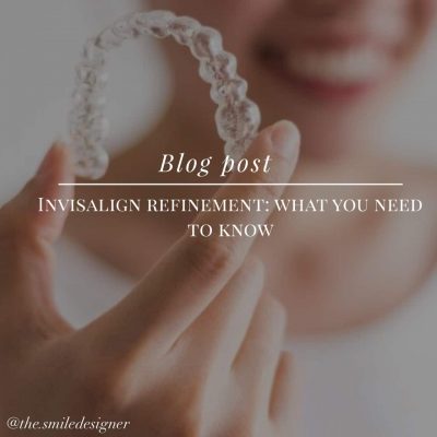 Invisalign Refinement