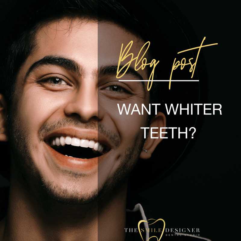 Want Whiter Teeth