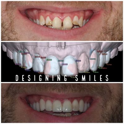 Designing smiles in Melbourne