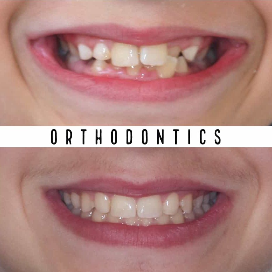 Orthodontics Preston Best Orthodontist Clinic Melbourne