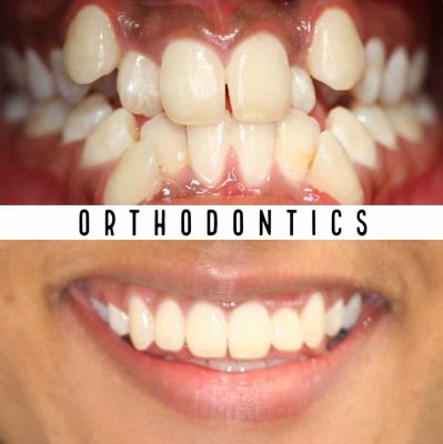 Orthodontics