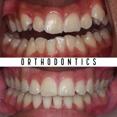 Orthodontics