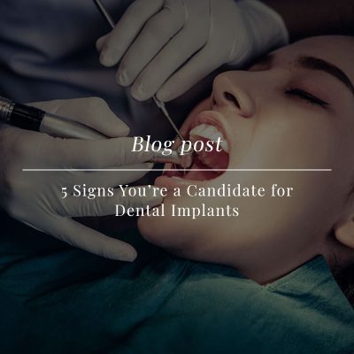 5 signs you should do dental implants