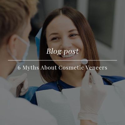 6 myths about cosmetic veneers