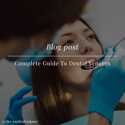 Complete-Guide-To-Dental-Veneers
