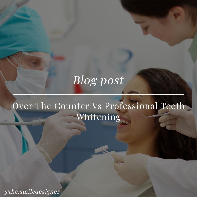Over The Counter vs Professional Teeth Whitening