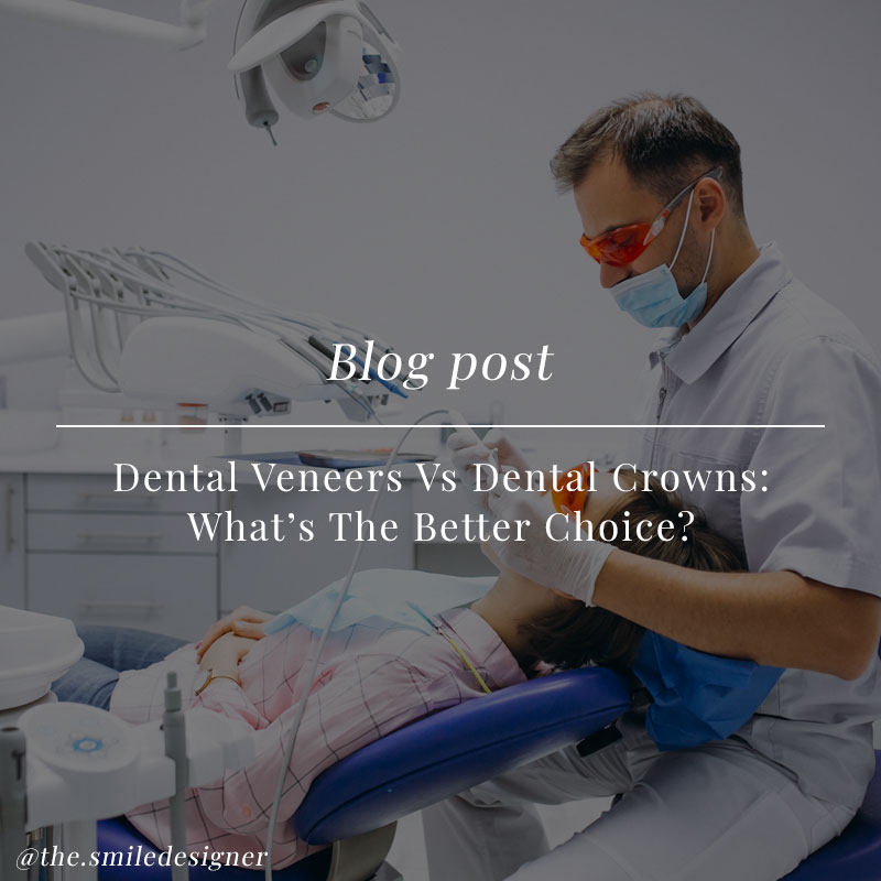 Dental Veneers Vs Dental Crowns: What's The Better Choice?