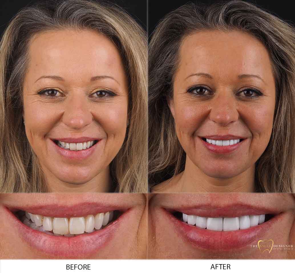 Alexandra's Photo of Before and After Dental Treatment