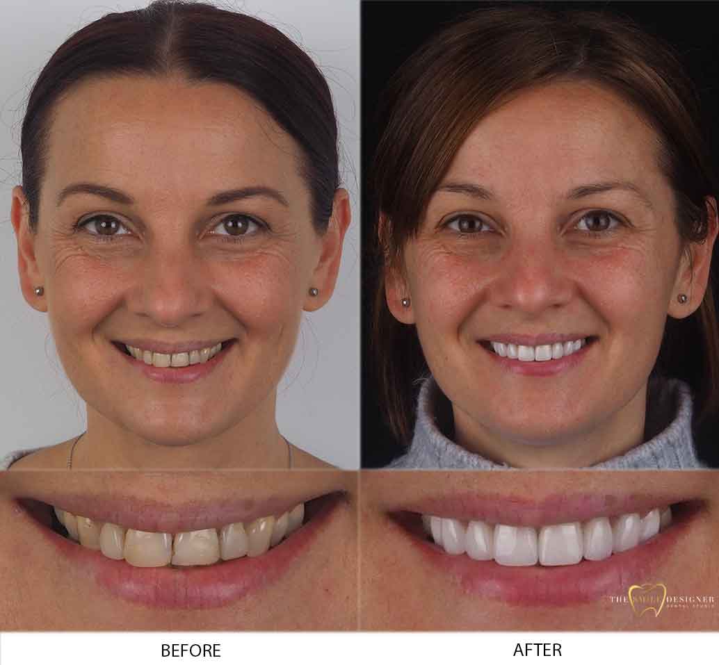 Amanda's Photo of Before and After Dental Treatment