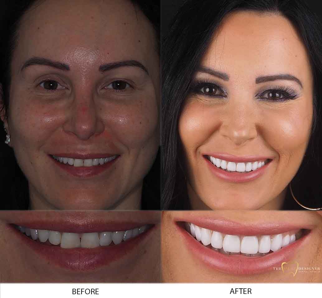 Carla's Photo of Before and After Dental Treatment