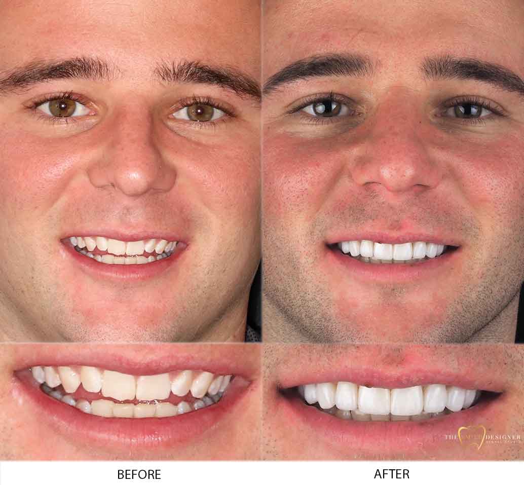 Jack's Photo of Before and After Dental Treatment