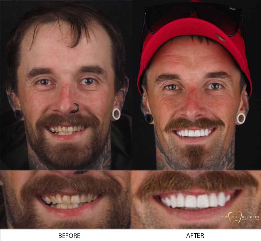 Jake's Photo of Before and After Dental Treatment