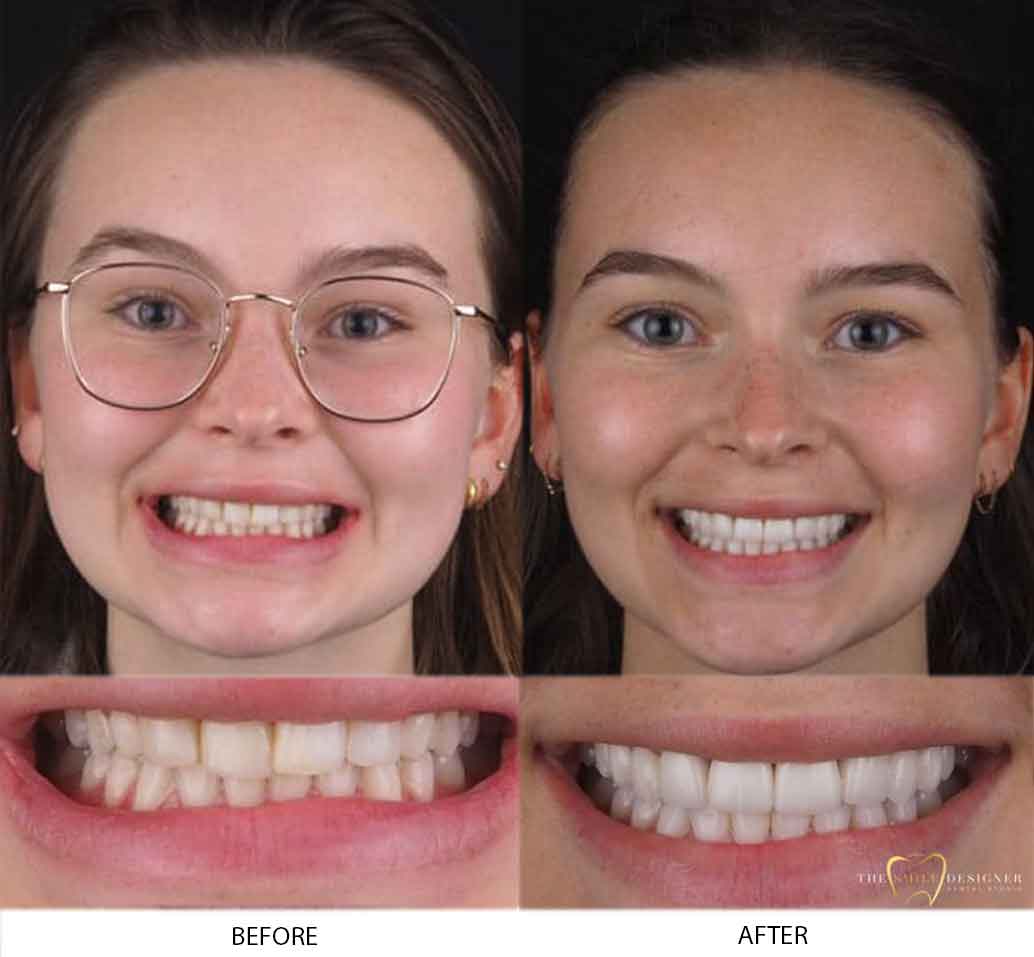 Lucy's Photo of Before and After Dental Treatment
