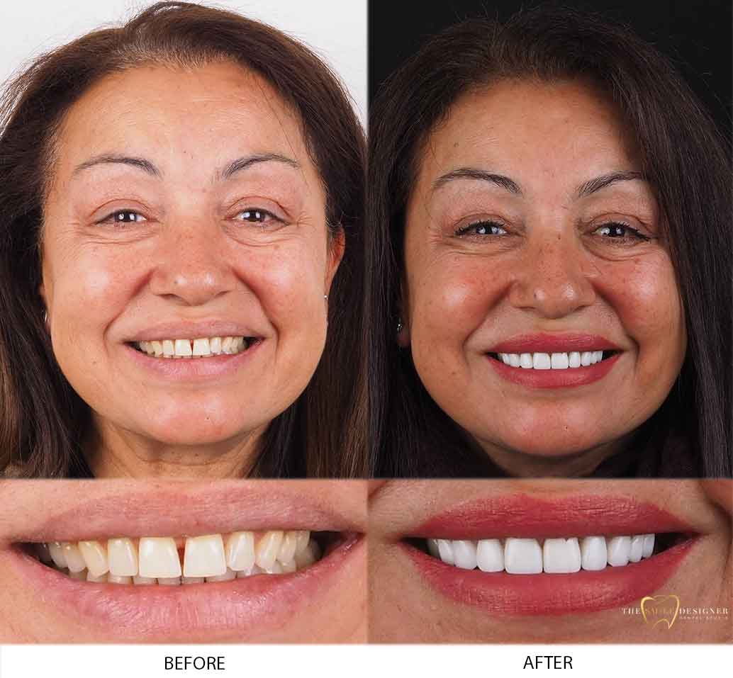Sahturna's Photo of Before and After Dental Treatment