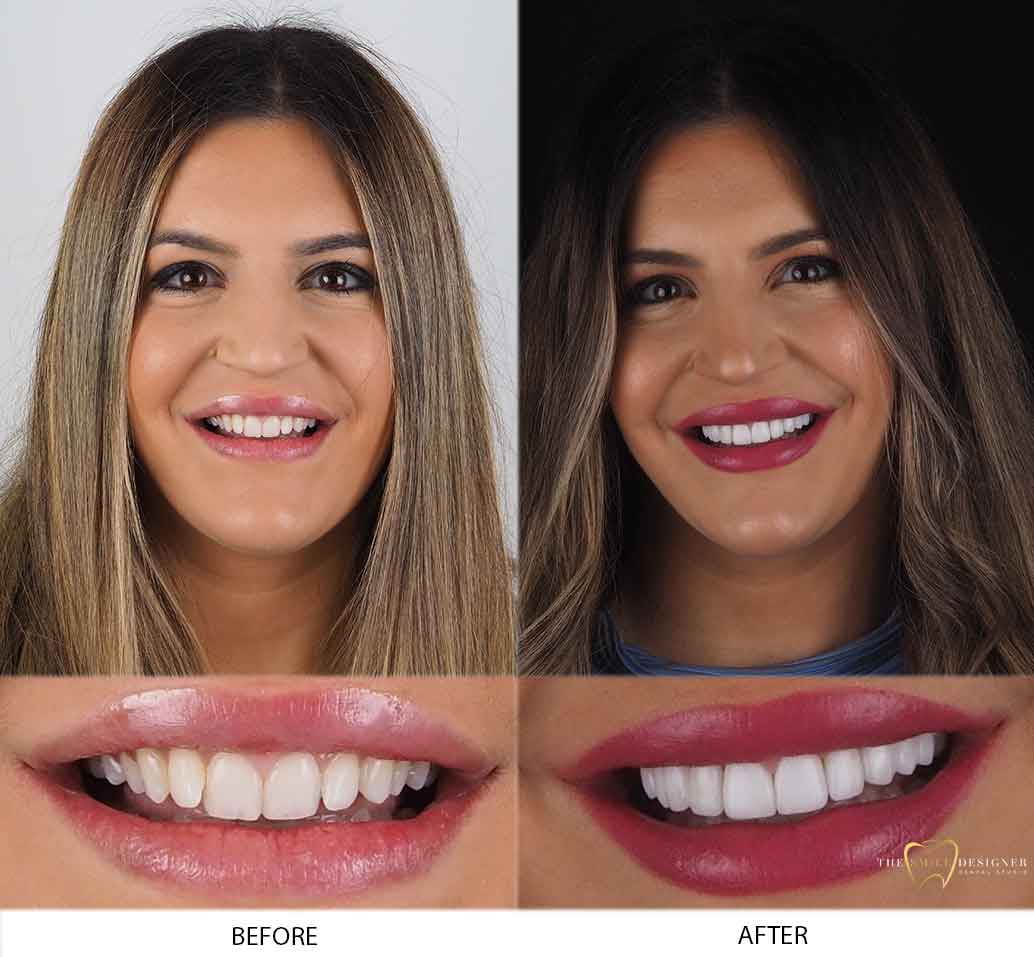 Suzannah's Photo of Before and After Dental Treatment