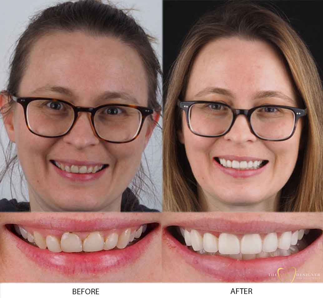 Amelia's Photo of Before and After Dental Treatment