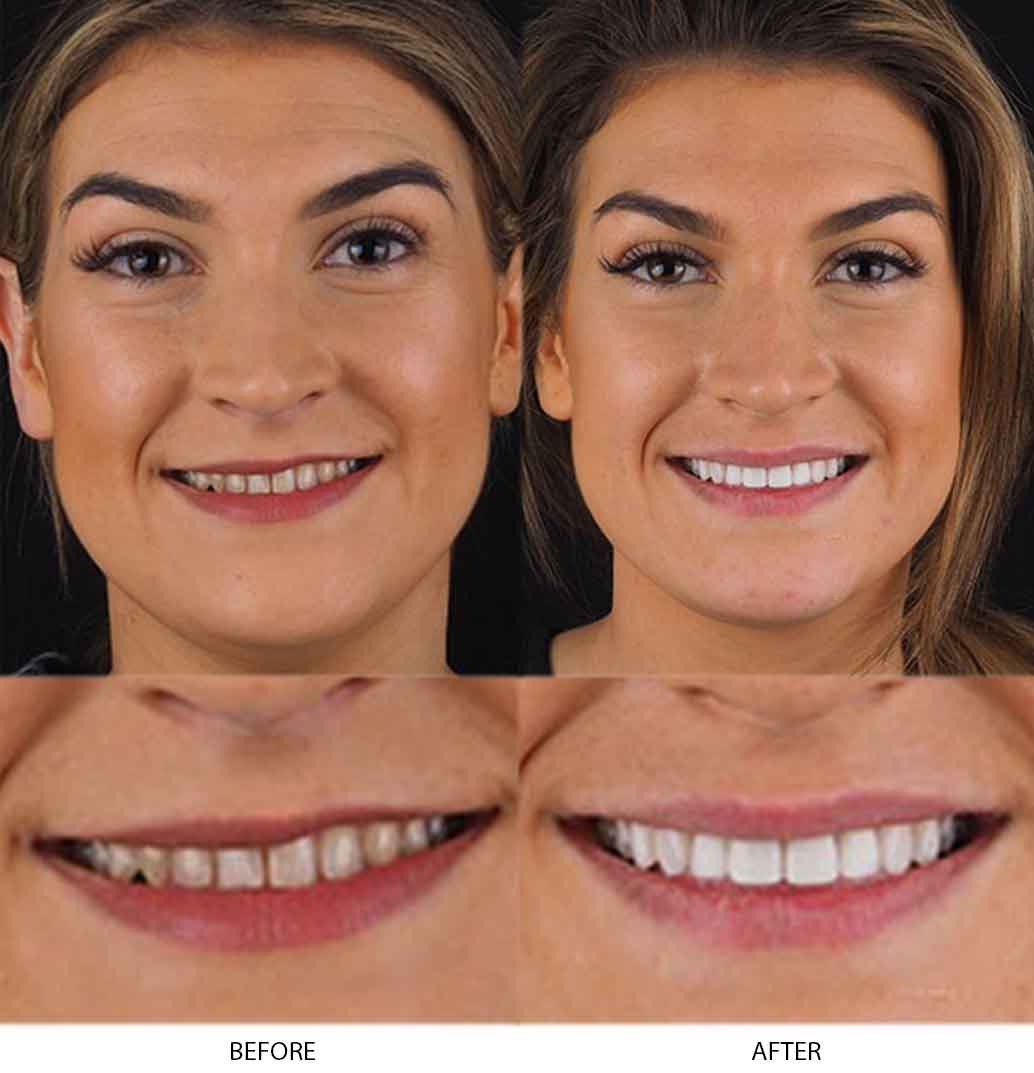 Amy's Photo of Before and After Dental Treatment