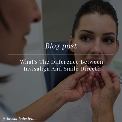 What's The Difference Between Invisalign And Smile Direct?