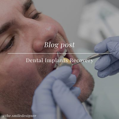 Dental Implants Recovery